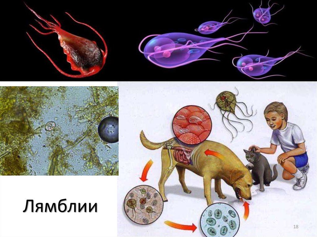 Лямблиоз: симптомы, причины, диагностика и лечение