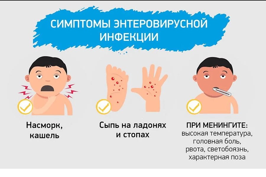 О мерах профилактики энтеровирусной инфекции