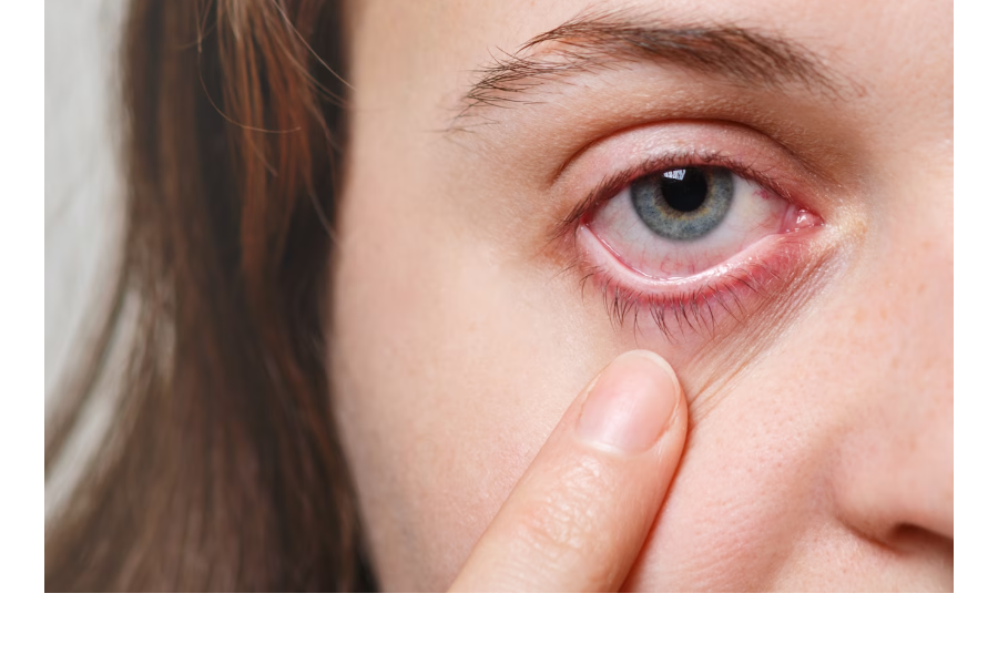 Офтальмологи предупреждают: туберкулез глаз - заболевание, которое требует срочного, сложного и длительного лечения